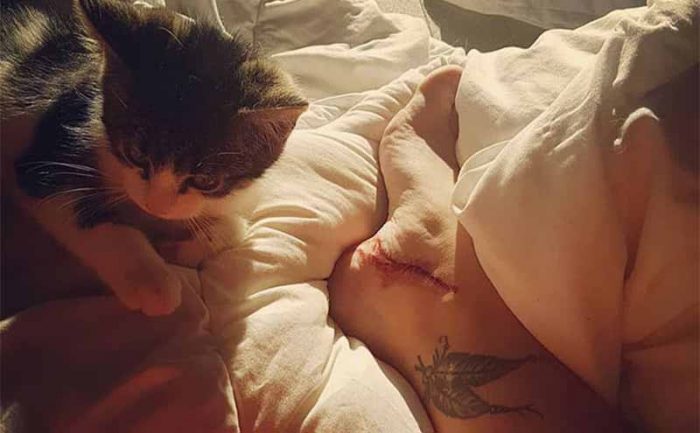 A cat sitting next to a person’s cut up foot 